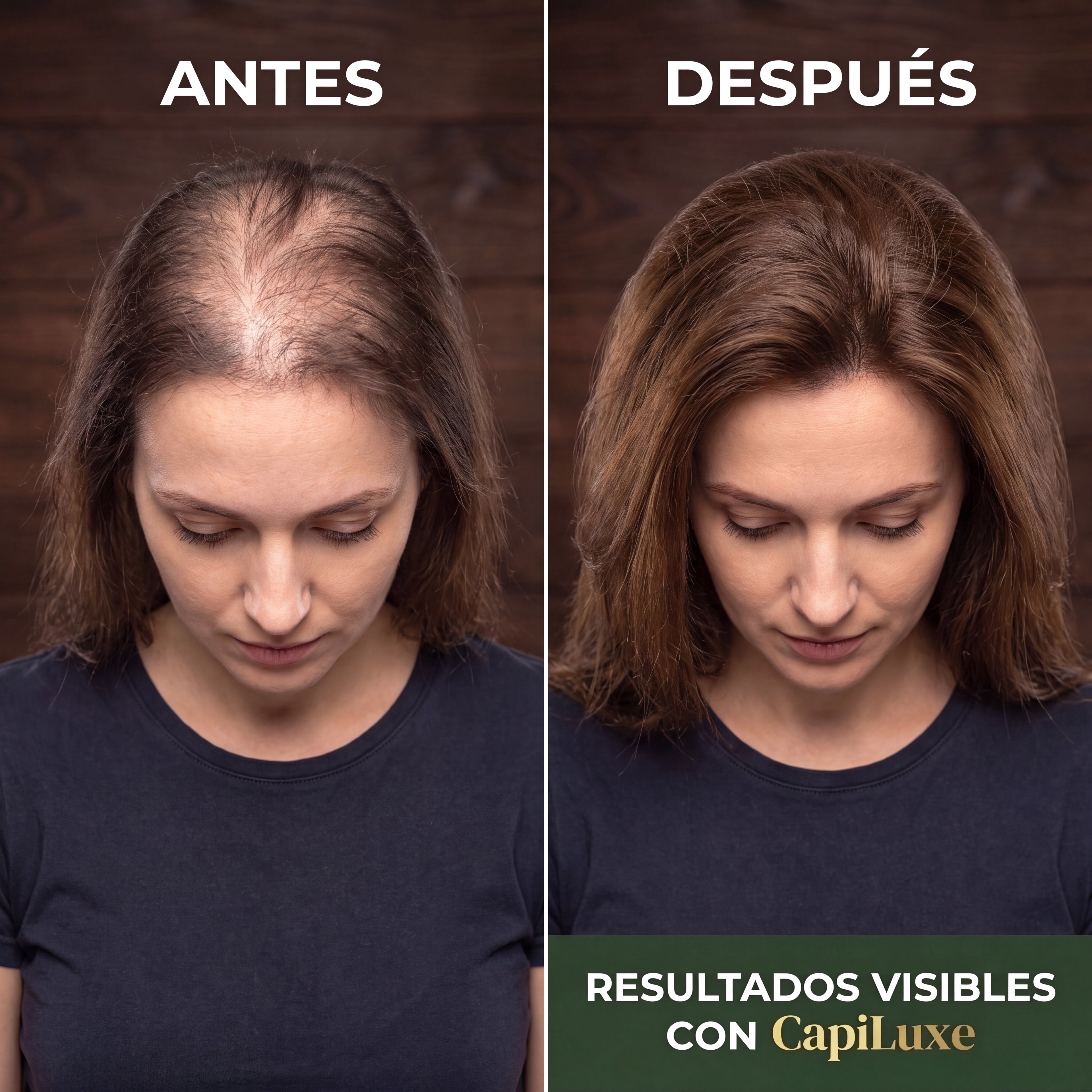 Capiluxe™ | Sérum Anticaída Premium